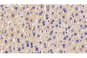Detection of ALPL in Mouse Liver Tissue using Polyclonal Antibody to Alkaline Phosphatase, Tissue-nonspecific (ALPL) (ALPL anticorps  (AA 18-335))