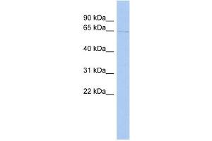 TIGD1 antibody used at 1 ug/ml to detect target protein. (IGD1 anticorps  (Middle Region))