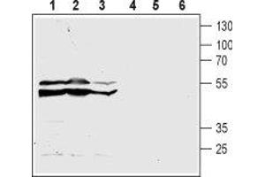 Western blot analysis of acute monocytic leukemia THP-1 (lanes 1 and 4), promyelocytic leukemia HL-60 (lanes 2 and 5) and chronic myelogenous leukemia K562 (lanes 3 and 6) human cell lysates: - 1-3. (CasLTR2 anticorps  (3rd Extracellular Loop))