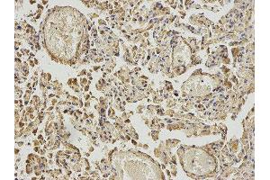 Immunohistochemistry (IHC) image for anti-4-Aminobutyrate Aminotransferase (ABAT) antibody (ABIN1876487) (ABAT anticorps)