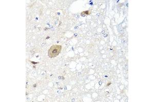 Immunohistochemistry of paraffin-embedded rat brain using FGF13 antibody.