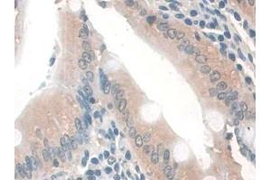 Detection of GAMT in Rat Small intestine Tissue using Polyclonal Antibody to Guanidinoacetate-N-Methyltransferase (GAMT)