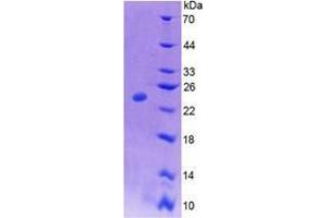 Image no. 1 for Colony Stimulating Factor 1 (Macrophage) (CSF1) (AA 33-204) (Active) protein (His tag) (ABIN6239892)
