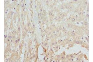 Immunohistochemistry of paraffin-embedded human liver tissue using ABIN7152931 at dilution of 1:100 (FCN1 anticorps  (AA 30-326))