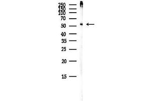 Western blot analysis of lysates from Mouse brain, using IFI Antibody at 1/1000 dilution.