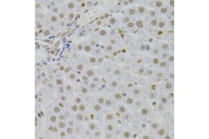 Immunohistochemistry of paraffin-embedded human liver using SFN Antibody. (14-3-3 sigma/SFN anticorps  (AA 1-248))