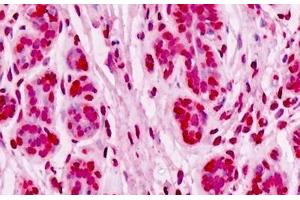 Human Breast, Epithelium: Formalin-Fixed, Paraffin-Embedded (FFPE) (UBE2D1 anticorps  (AA 1-95))