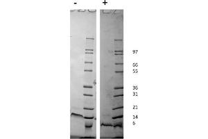 SDS-PAGE of Human Stromal Cell-Derived Factor-1 alpha (CXCL12) Recombinant Protein. (CXCL12 Protéine)
