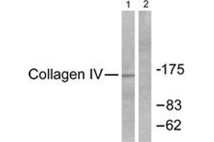 Western blot analysis of extracts from HeLa cells, using Collagen IV Antibody. (Collagen IV anticorps  (AA 11-60))