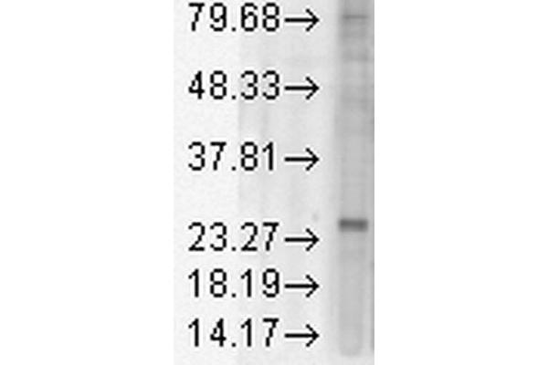 KDELR Antikörper  (AA 192-212) (HRP)