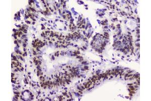 IHC analysis of RbAp48 using anti-RbAp48 antibody (ABIN5692929). (Retinoblastoma Binding Protein 4 anticorps  (C-Term))