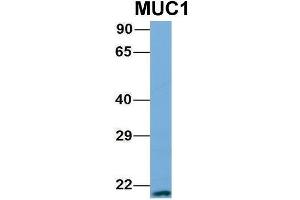 Host:  Rabbit  Target Name:  MUC1  Sample Type:  721_B  Antibody Dilution:  1. (MUC1 anticorps  (N-Term))