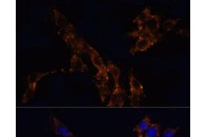 Immunofluorescence analysis of NIH/3T3 cells using TGFB1 Polyclonal Antibody at dilution of 1:100. (TGFB1 anticorps)