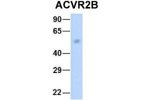 Host:  Rabbit  Target Name:  GNAS  Sample Type:  Human Fetal Heart  Antibody Dilution:  1.