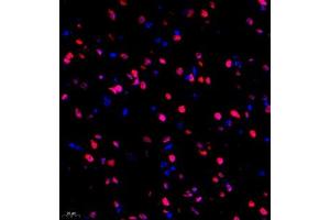 Immunofluorescence of paraffin embedded mouse brain using HRP3 (ABIN7074198) at dilution of 1:2000 (400x lens)