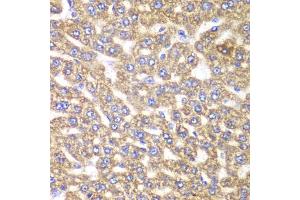 Immunohistochemistry of paraffin-embedded rat liver using UGDH antibody (ABIN6293152) at dilution of 1:100 (40x lens). (UGDH anticorps)