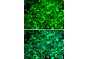 Immunofluorescence analysis of U2OS cells using ADIPOR1 antibody (ABIN5970705). (Adiponectin Receptor 1 anticorps)