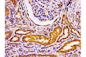 Immunohistochemistry of paraffin-embedded human kidney tissue using ABIN7145438 at dilution of 1:100