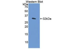 Western blot analysis of the recombinant protein. (IRF6 anticorps  (AA 196-445))