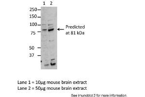 Sample Type: Lane1 = 10ug mouse brain extract, Lane 2 = 50ug mouse brain extractPrimary Antibody Dilution: Anti-MARK3 1:2500Submitted By: Dr. (MARK3 anticorps  (Middle Region))