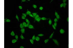 Immunofluorescence staining of SH-SY5Y cells with ABIN7151213 at 1:133, counter-stained with DAPI.
