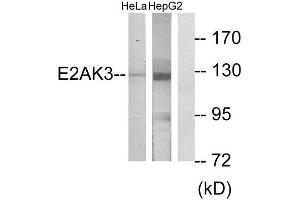 Western Blotting (WB) image for anti-Eukaryotic Translation Initiation Factor 2-alpha Kinase 3 (EIF2AK3) (N-Term) antibody (ABIN1850024) (PERK anticorps  (N-Term))