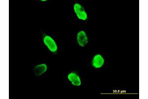 Immunofluorescence of purified MaxPab antibody to SUMO3 on HeLa cell.