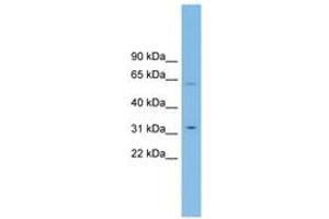 Image no. 1 for anti-Solute Carrier Family 39 (Zinc Transporter), Member 9 (SLC39A9) (AA 107-156) antibody (ABIN6744759) (SLC39A9 anticorps  (AA 107-156))