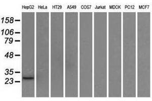 Image no. 3 for anti-Hydroxysteroid (17-Beta) Dehydrogenase 10 (HSD17B10) antibody (ABIN1498723) (HSD17B10 anticorps)