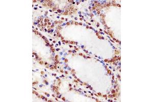 (ABIN6243590 and ABIN6578256) staining HNRNPUL2 in human stomach tissue sections by Immunohistochemistry (IHC-P - paraformaldehyde-fixed, paraffin-embedded sections). (HNRNPUL2 anticorps  (AA 337-350))
