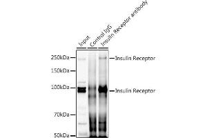 Immunoprecipitation analysis of 300 μg extracts of HeLa cells using 3 μg Insulin Receptor antibody (ABIN7267890). (Insulin Receptor anticorps  (AA 1281-1382))