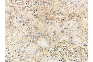 anti-RAB, Member RAS Oncogene Family-Like 5 (RABL5) (Internal Region) antibody
