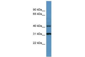 WB Suggested Anti-Ctsd Antibody Titration: 0. (Cathepsin D anticorps  (C-Term))