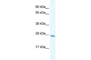 WB Suggested Anti-GTF2F2 Antibody Titration: 0.