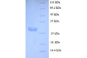 SDS-PAGE (SDS) image for Myonase (MCPT4) (AA 21-246) protein (His tag) (ABIN5710824)