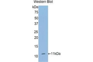 Detection of Recombinant COL2, Human using Polyclonal Antibody to Collagen Type II Alpha 1 (COL2a1)