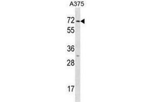 KRT75 Antibody (N-term) western blot analysis in A375 cell line lysates (35µg/lane). (Keratin 75 anticorps  (N-Term))
