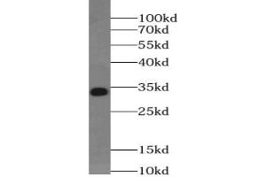 Western blot analysis of Jurkat cells subjected to SDS-PAGE using UCK2 Antibody at a dilution of 1/500. (UCK2 anticorps)