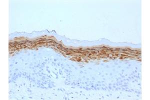 Formalin-fixed, paraffin-embedded human Skin stained with Filaggrin Mouse Monoclonal Antibody (FLG/1561). (Filaggrin anticorps  (AA 198-288))