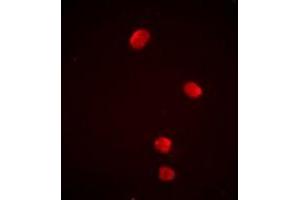 Immunofluorescent analysis of PSMD13 staining in Jurkat cells.