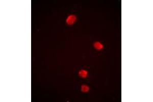 Immunofluorescent analysis of PSMD13 staining in Jurkat cells. (PSMD13 anticorps)