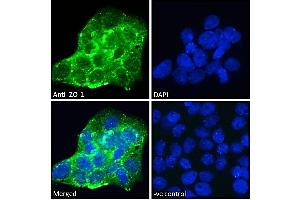 ABIN570961 Immunofluorescence analysis of paraformaldehyde fixed A431 cells, permeabilized with 0. (TJP1 anticorps  (Internal Region))