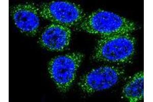 Confocal immunofluorescent analysis of Hela cells using MUTYH Antibody , followed by Alexa Fluor® 488-conjugated goat anti-rabbit lgG (green).