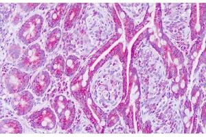Image no. 2 for anti-Mitochondrial Ribosomal Protein L12 (MRPL12) (AA 87-136) antibody (ABIN6749796)