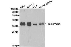 Western Blotting (WB) image for anti-Heterogeneous Nuclear Ribonucleoprotein A2/B1 (HNRNPA2B1) antibody (ABIN1873065) (HNRNPA2B1 anticorps)