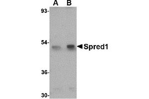 Western Blotting (WB) image for anti-Sprouty-Related, EVH1 Domain Containing 1 (SPRED1) (Middle Region 1) antibody (ABIN1031192) (SPRED1 anticorps  (Middle Region 1))