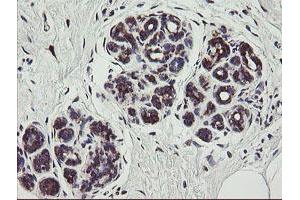 Immunohistochemistry (IHC) image for anti-Tumor Protein D52-Like 3 (TPD52L3) antibody (ABIN1501475)