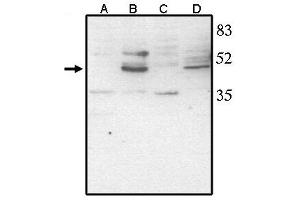 Western Blotting (WB) image for anti-Visual System Homeobox 2 (VSX2) antibody (ABIN293468)