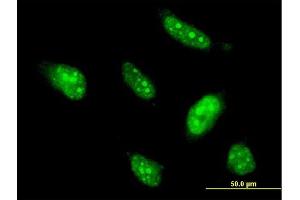 Immunofluorescence of monoclonal antibody to BTG4 on HeLa cell. (BTG4 anticorps  (AA 1-206))