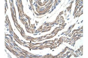 STK11 antibody was used for immunohistochemistry at a concentration of 4-8 ug/ml to stain Skeletal muscle cells (arrows) in Human Muscle. (LKB1 anticorps  (N-Term))